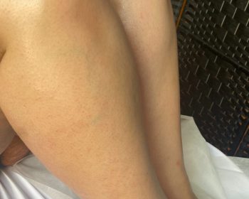 Two bare legs resting on a white cloth, with a black woven chair in the background.